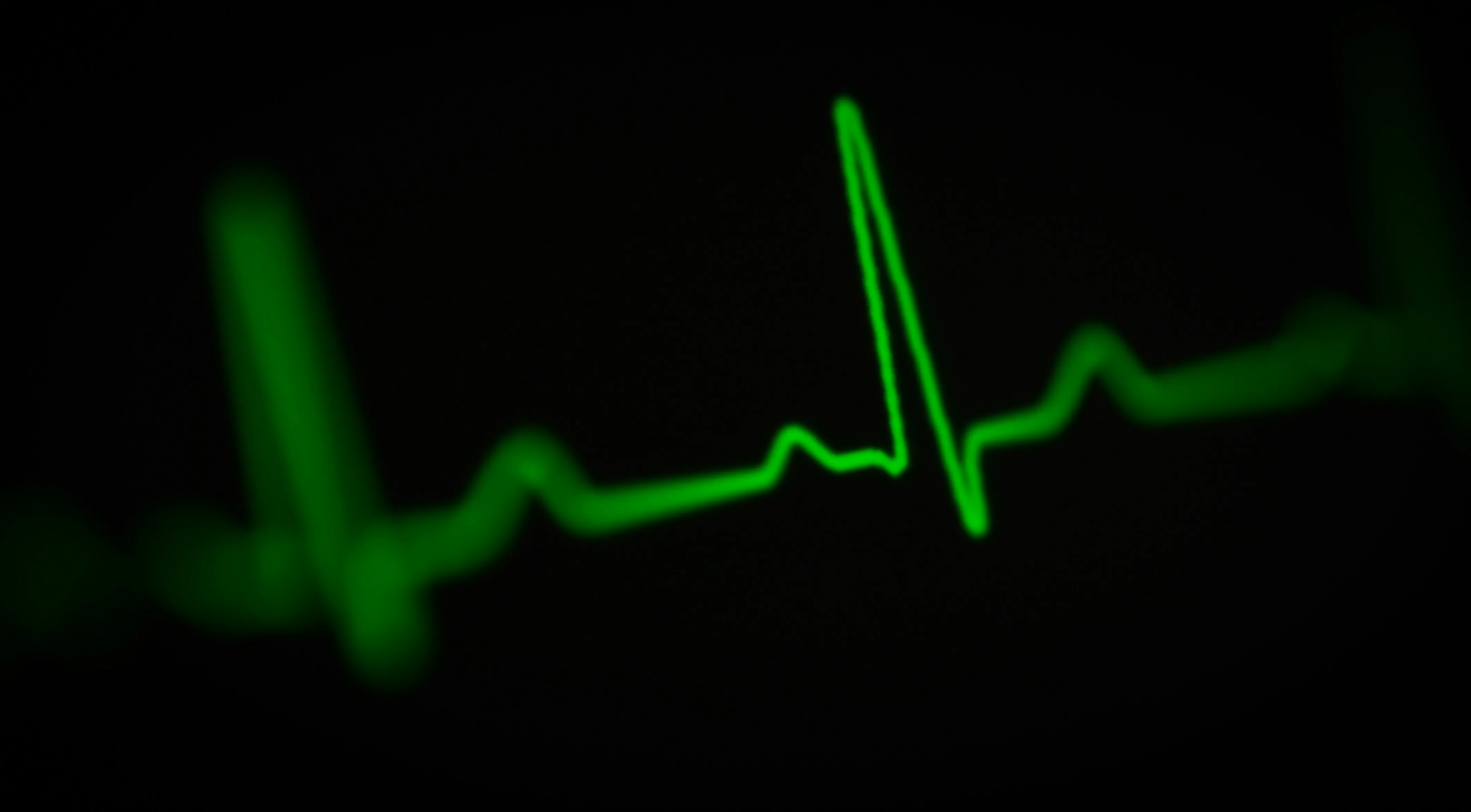HeartSure
